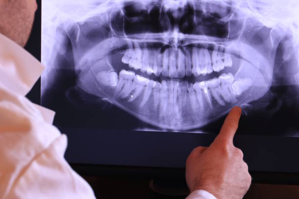 Best Emergency Cosmetic Dentistry in Sa Conejo, CA